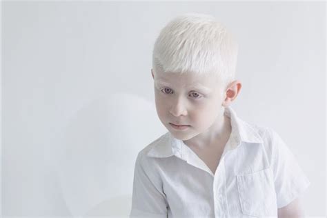 Albinismus Fotos | POPSUGAR Celebrity Germany | Albinism, Beauty ...