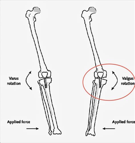 Camden Depot: A Brief Overview of Manny Machado's Knee Injury