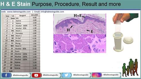 Hematoxylin and Eosin (H&E) Stain | Lab Tests Guide