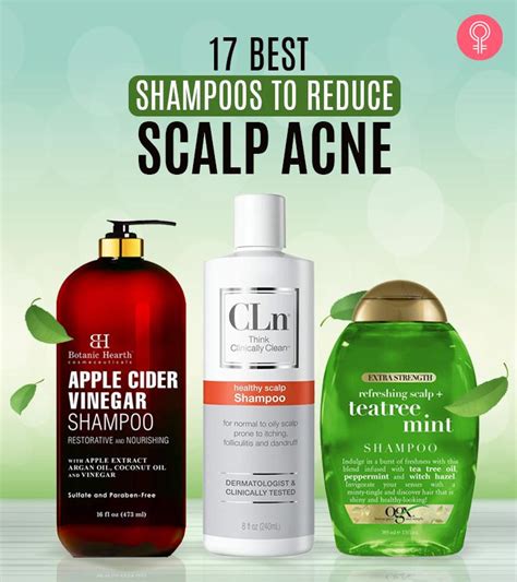 These Are The 17 Best Scalp Acne Shampoos To Try In 2023