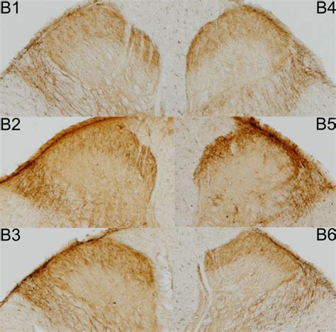 Photomicrographs of superficial dorsal horn sections. Examples of ...