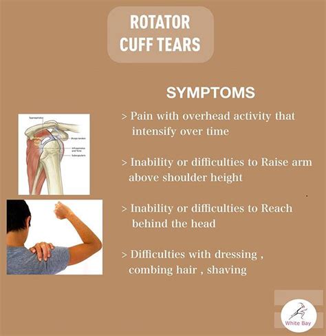 Rotator Cuff Tear Symptoms Pain