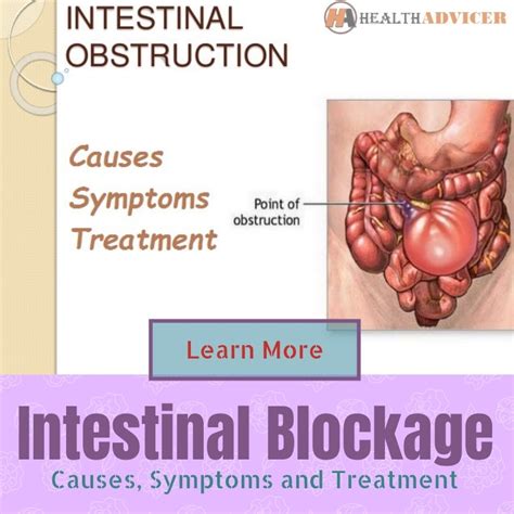 Intestinal Blockage - Causes, Picture, Symptoms, And Treatment