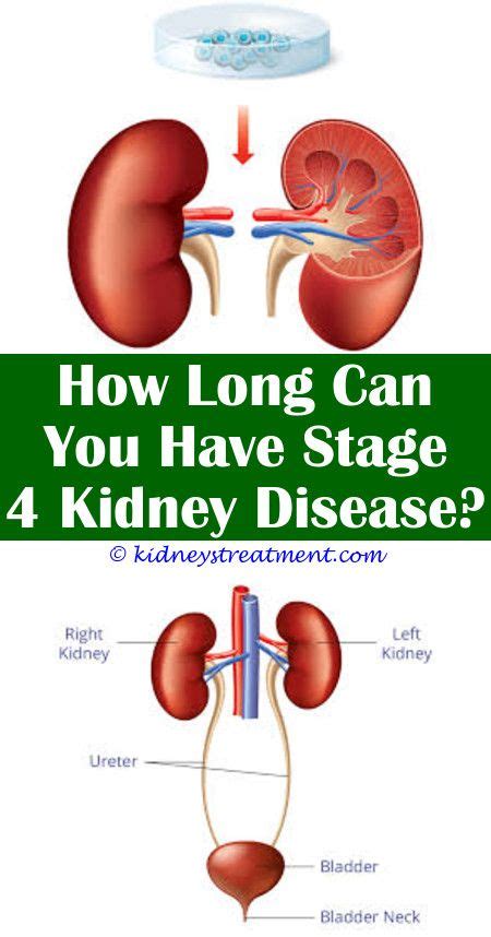 Renal Failure Dogs | Polycystic kidney disease, Kidney disease symptoms, Kidney disease