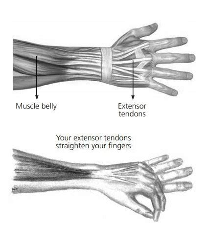 Hand Therapy - Extensor Tendon Finger Repair (Merritt) - North Tees and Hartlepool NHS ...