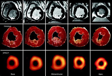 Cardiovascular MRI for detection of myocardial viability and ischaemia ...