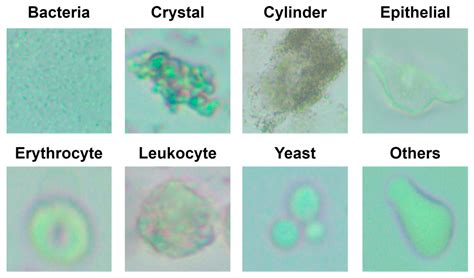 Diagnostics | Free Full-Text | Automatic Classification of Particles in ...