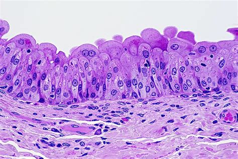 Transitional Epithelium of Human Bladder (Magnification x100). H & E stain. Cells near the ...