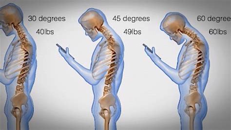 Forward neck posture exercises: 9 best choice