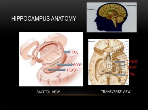 Mesial temporal lobe epilepsy