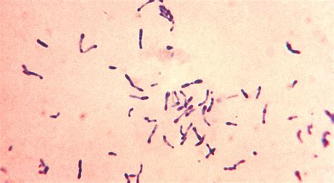 Environmental Isolate Case File: Corynebacterium spp. – Microbiologics Blog