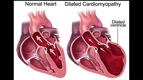 Alcohol's Effect on Blood Pressure and Heart Rate