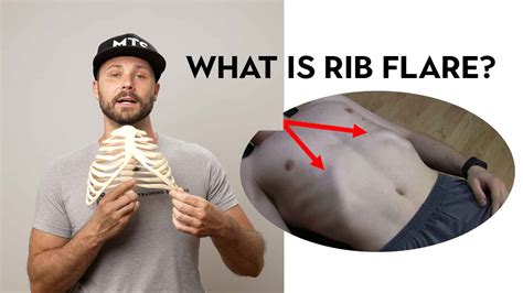 What Is Rib Flare? Watch To Learn How To Fix (Part 1 of 2) - YouTube