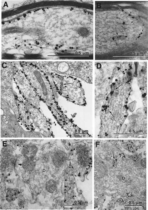 SNAP-25 labeling in axons vs. dendrites. Fig. 2A and B -examples of... | Download Scientific Diagram