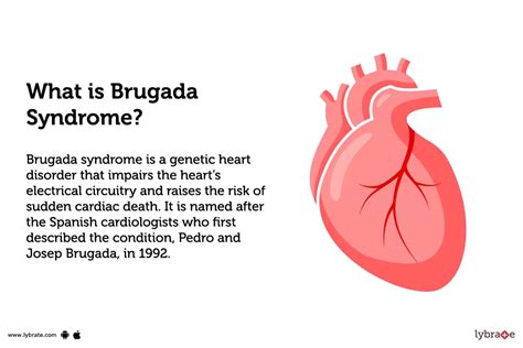 Brugada Syndrome: Treatment, Procedure, Cost, Recovery, Side Effects And More