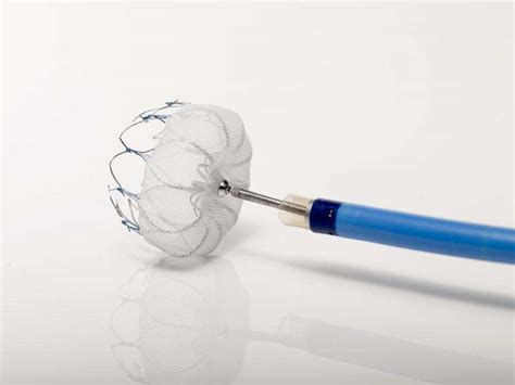 WATCHMAN heart device gives patients alternative to blood thinners and reduces stroke risk