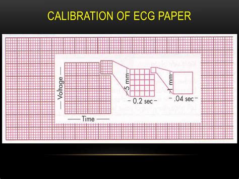 PPT - ECG Basics PowerPoint Presentation, free download - ID:7056722