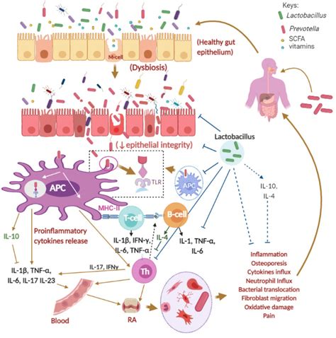 Rheumatoid Arthritis and Prevotella copri | Encyclopedia MDPI