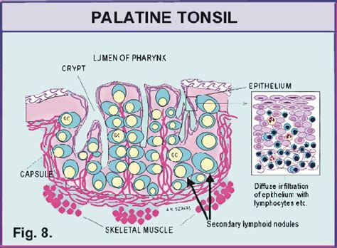 5. DIAGNOSTIC FEATURES: Presence of crypts and incomplete capsule ; See ...