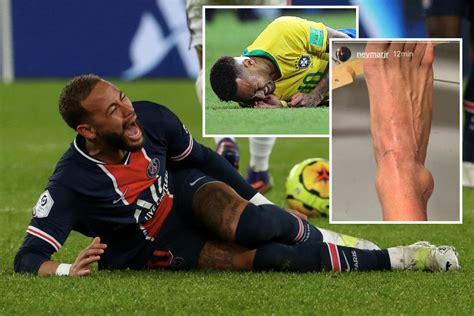 Neymar's injuries through the years, from ruptured ankle ligaments to back fracture and testing ...