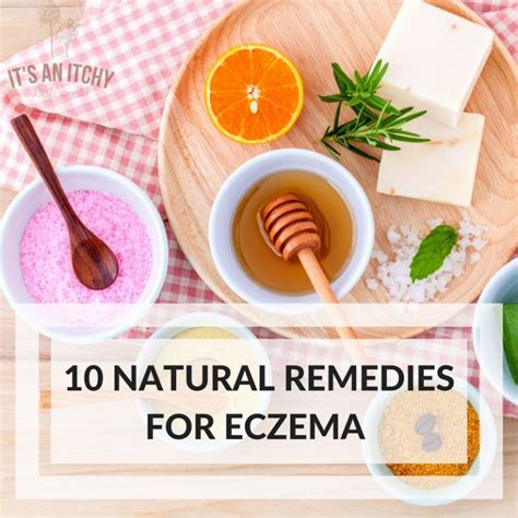10 Natural Home Remedies for Eczema To Try at Home Today