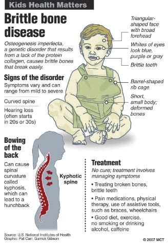 Brittle bone disease can't keep local teen down | Texas | kdhnews.com