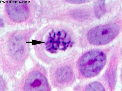 EC Honors Biology: Metaphase and Anaphase questions