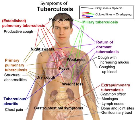 Rachel Lanoue's HSC4233 Blog : Tuberculosis: What is it exactly?