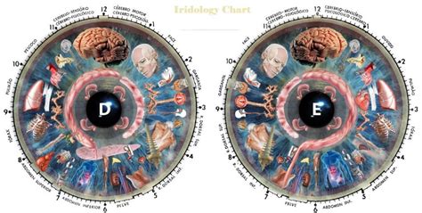 iris diagnosis chart - MAIKONG Iridology Cameras & Iriscope-Leading ...