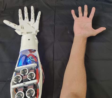 Designing a 3D-printed EMG bionic hand as a low-cost alternative to prosthetic limbs | Arduino Blog