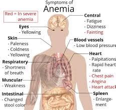 Macrocytic Anemia - Causes, Symptoms, Treatment, What is