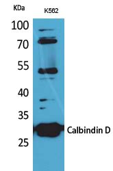 Calbindin D28K Polyclonal Antibody - SAB | Signalway Antibody