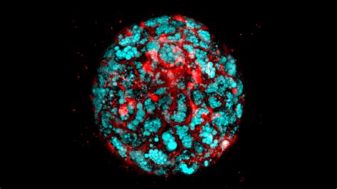 Can Organoids Yield Answers to Fatty Liver Disease? – NIH Director's Blog