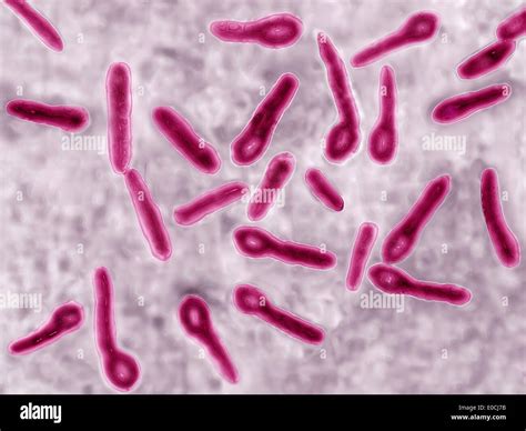 Clostridium Tetani Symptoms