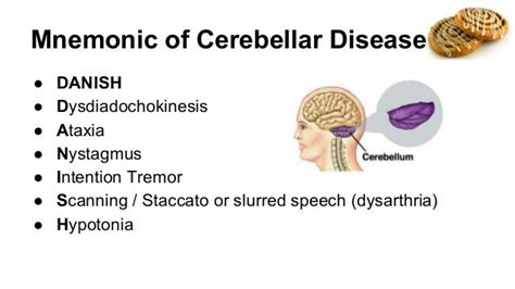 Cerebellar Signs | Antrim ED Meducation