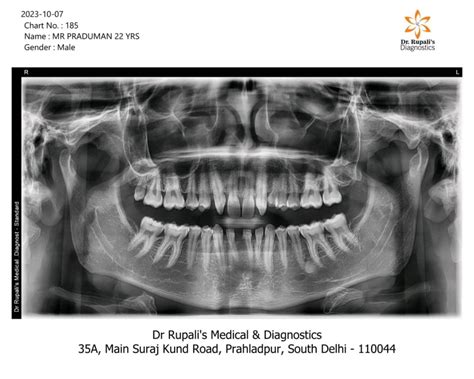 OPG Dental X-Ray in South Delhi at Dr. Rupali's Medical