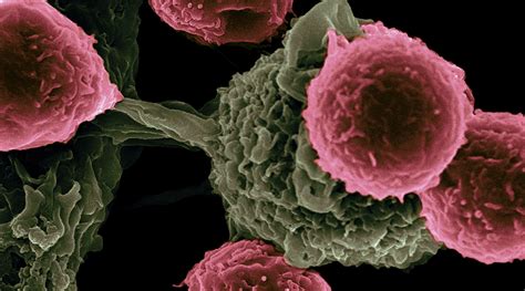 A needed boost for anti-tumor immunotherapy - Advanced Science News