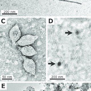 (PDF) Experimental fossilisation of viruses from extremophilic Archaea