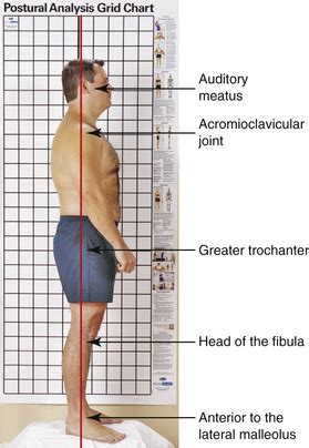 Assessment | Musculoskeletal Key