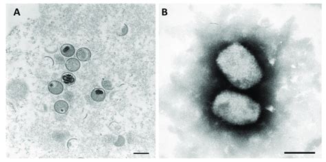 Monkeypox virus under transmission electron microscope. (A) utilizing ...