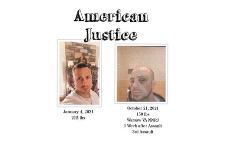 J6 Political Prisoner Ryan Samsel Beaten By Prison Guards, Loses Vision in One Eye – Now He Is ...