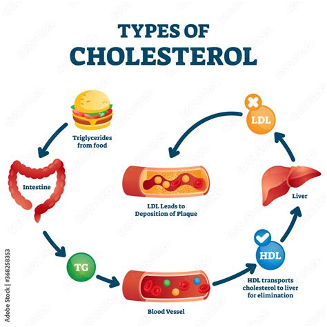 Types of cholesterol educational cycle scheme from fatty food to LDL ...