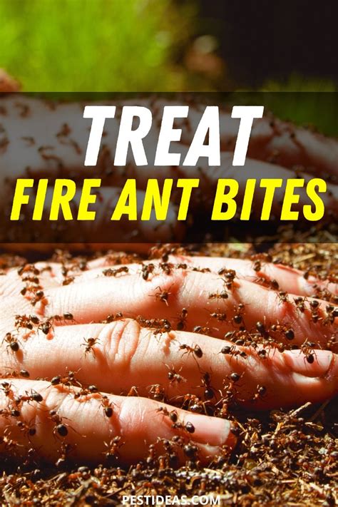 Treat Fire Ant Bites- No More Itch