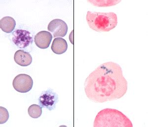 Siderocytes in a cat | eClinpath