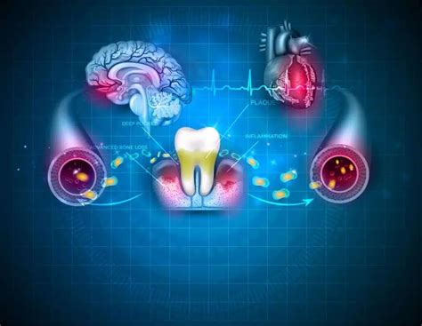 Gum Disease And Dementia