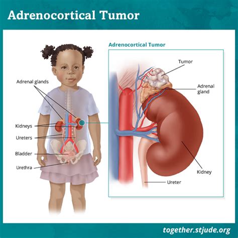 Can Adrenal Glands Regenerate? Unveiling The Bodys Remarkable Potential