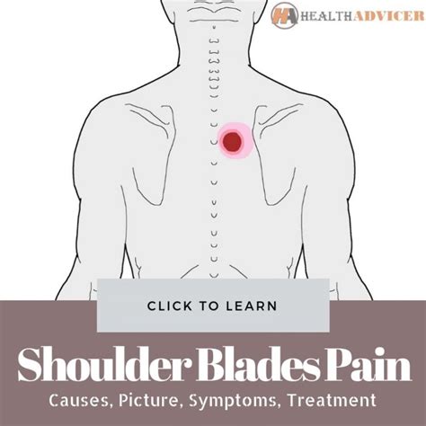 Pain Between Shoulder Blades: Symptoms, Diagnosis And Treatment