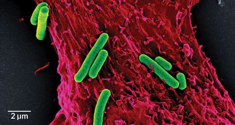 New heart attack treatment uses photosynthetic bacteria to make oxygen