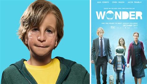 Wonder 2017 Film Review | HubPages