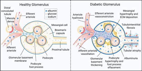 Frontiers | Rotten to the Cortex: Ceramide-Mediated Lipotoxicity in Diabetic Kidney Disease